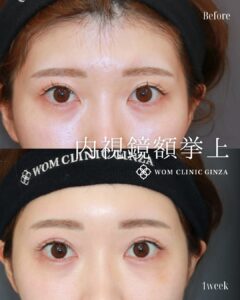 髙田医師の症例01