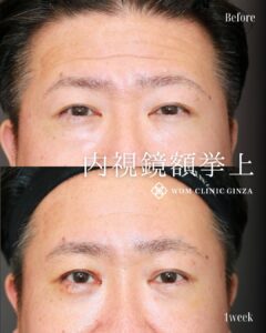 髙田医師の症例02