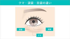 クマと涙袋・目袋の違い