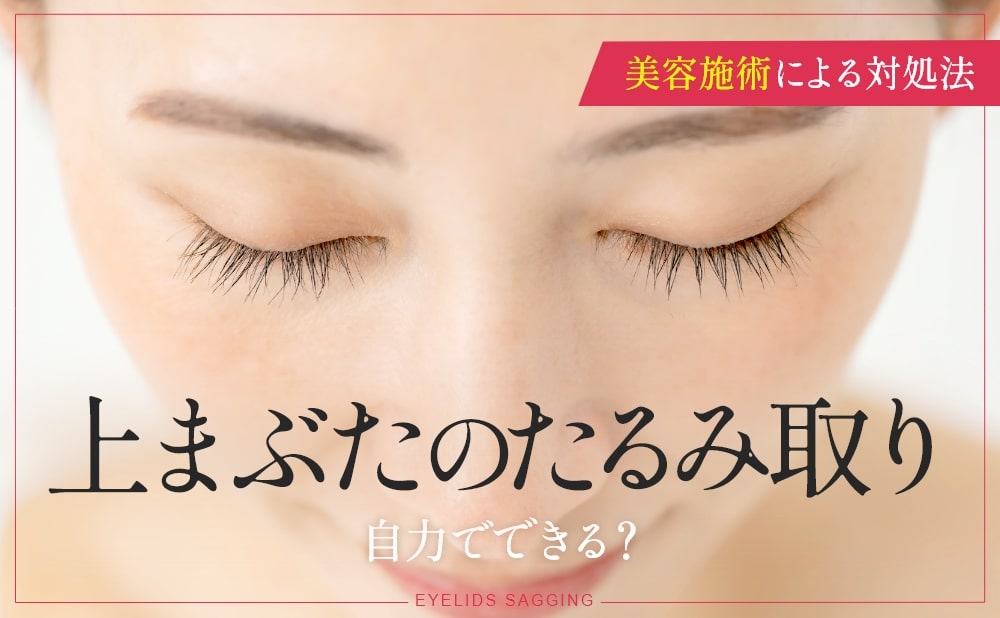 上まぶたのたるみ取りは自力でできる？美容施術による対処法とは​