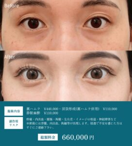 裏ハムラの症例写真03