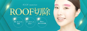 ROOF切除_TOP _MV_pc