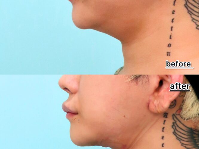 22008カナイヤストシ１D