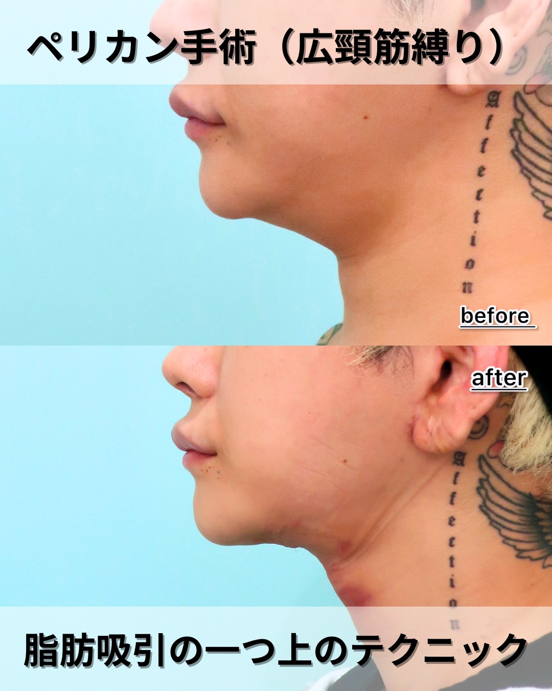 22008カナイヤストシ１D