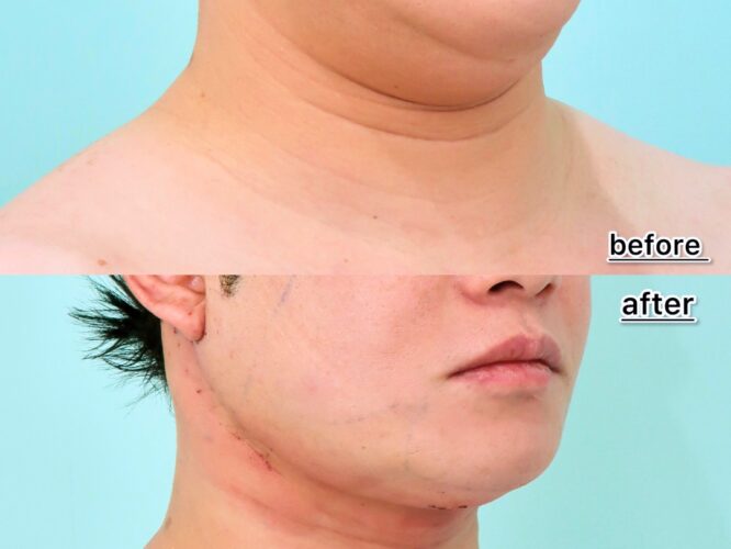 21911ミヤウチオサム 1D