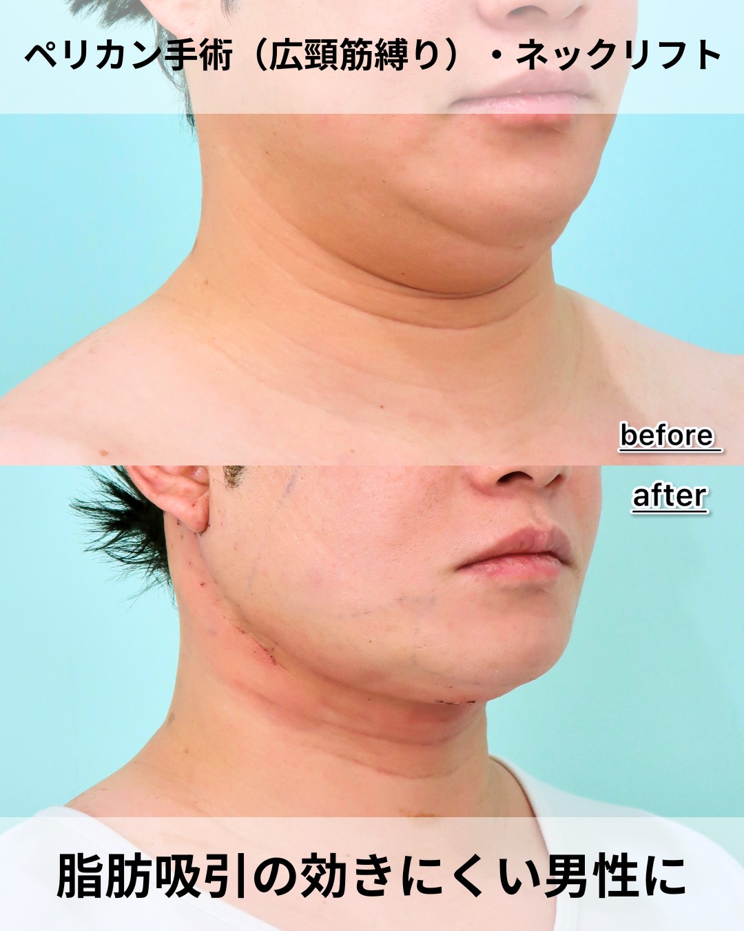 21911ミヤウチオサム 1D