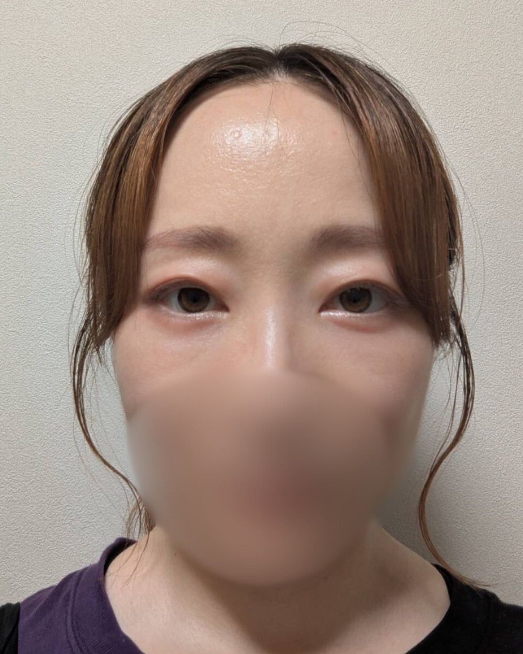 裏ハムラでマイナス10歳若返り! AFTER写真