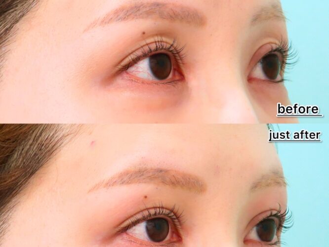 21460クラシマヒカル