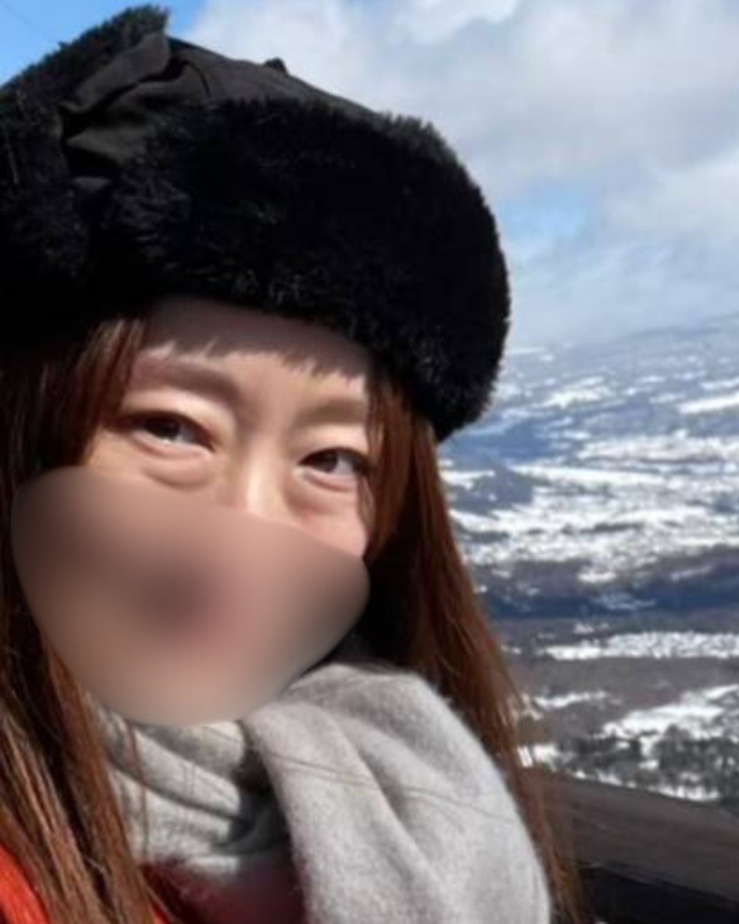 裏ハムラでマイナス10歳若返り! BEFORE写真