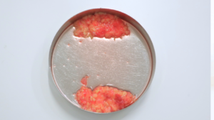 『左右差の目立つ口横のポニョ、その原因は？』の画像