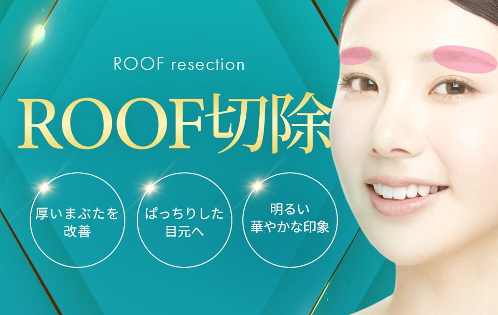 ROOF切除