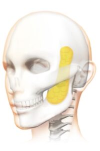 『左右差の目立つ口横のポニョ、その原因は？』の画像