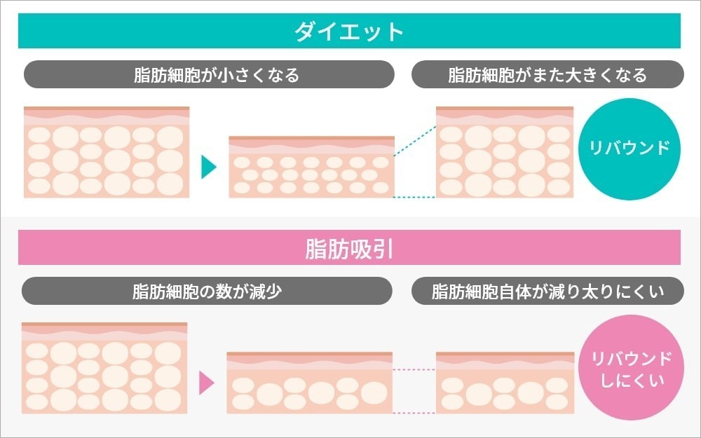 ダイエットと脂肪吸引の比較図