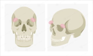 アイホールボーン削りの施術位置、眼球が収まっているくぼみの骨