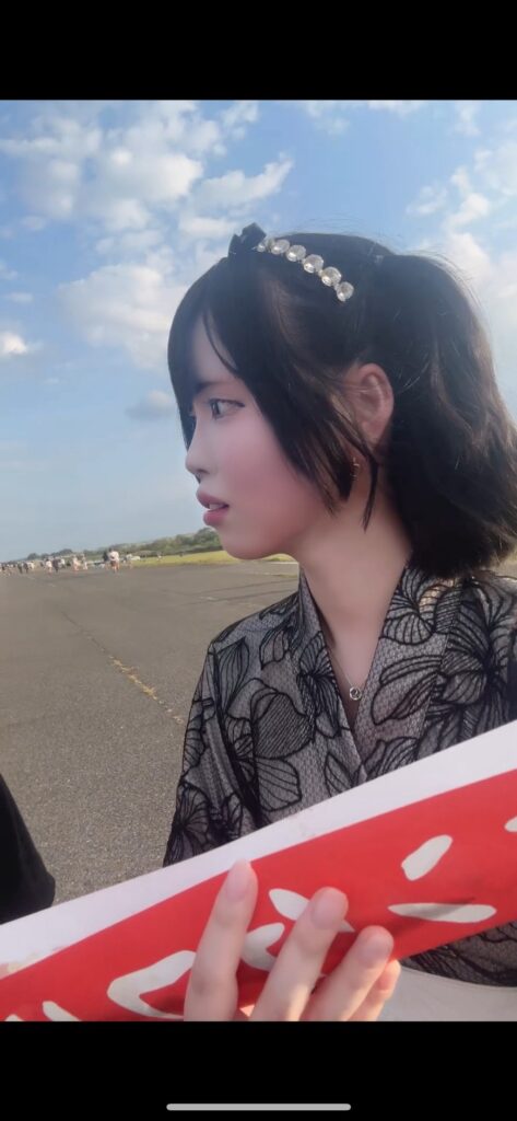 鼻フルで口元の突出感解消! BEFORE写真
