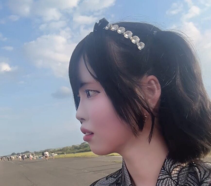 鼻フルで口元の突出感解消! BEFORE写真