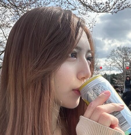 わし鼻を解消 BEFORE写真