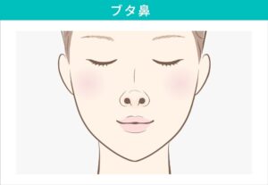 ブタ鼻の女性のイラスト