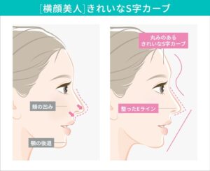 横顔の鼻のS字カーブとEラインの比較