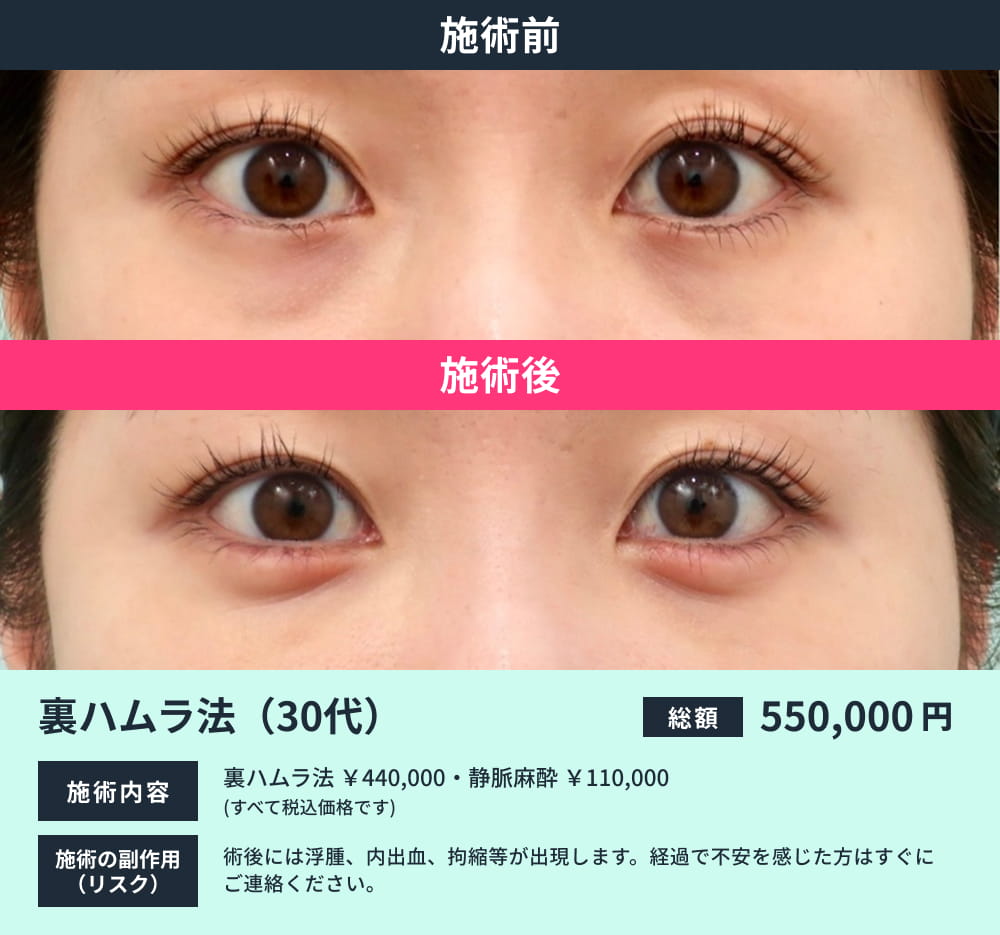 裏ハムラ(30代)のビフォーアフター