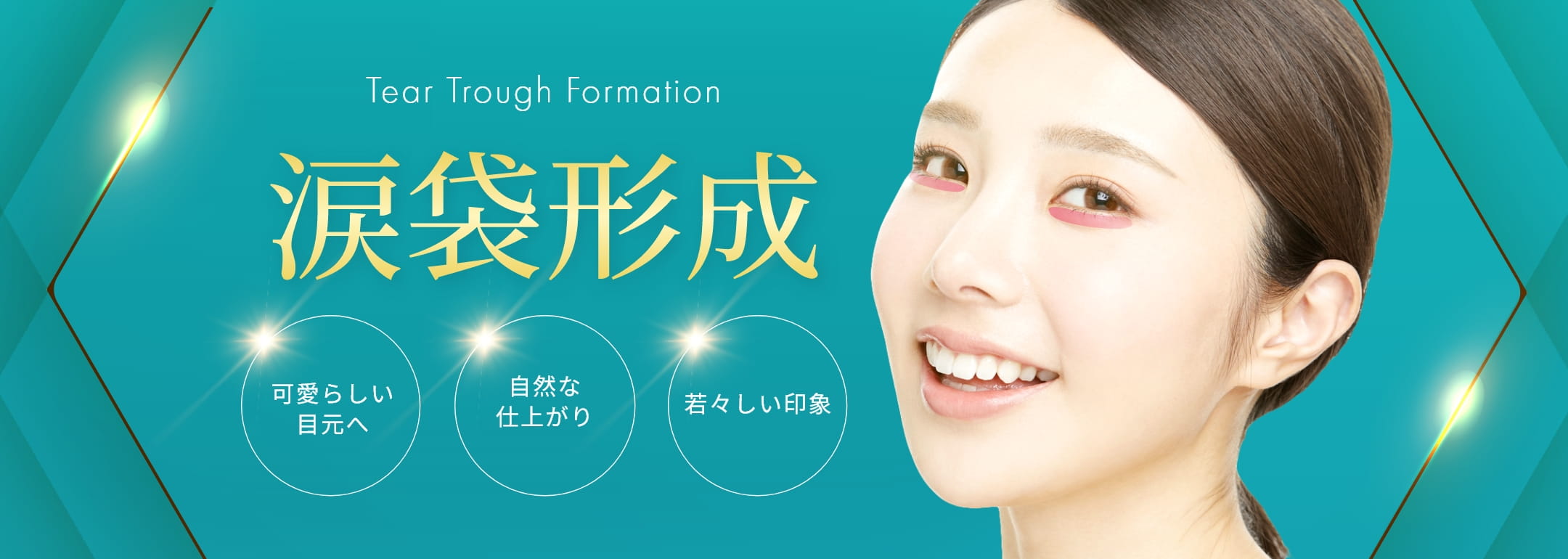涙袋形成