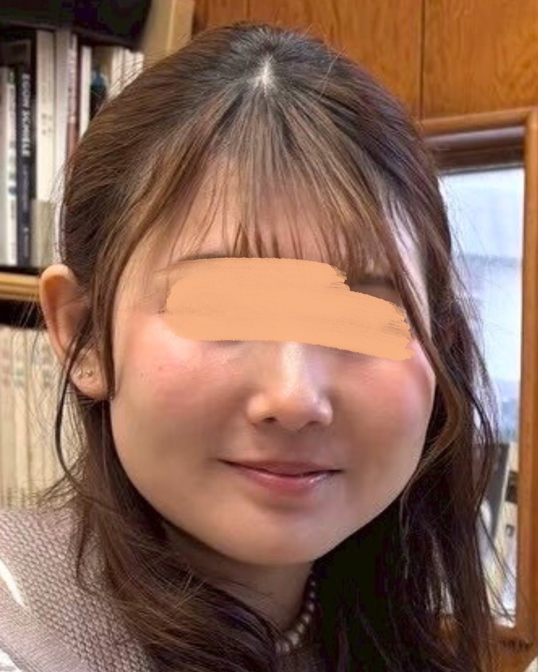 人生変わる小顔術 BEFORE写真