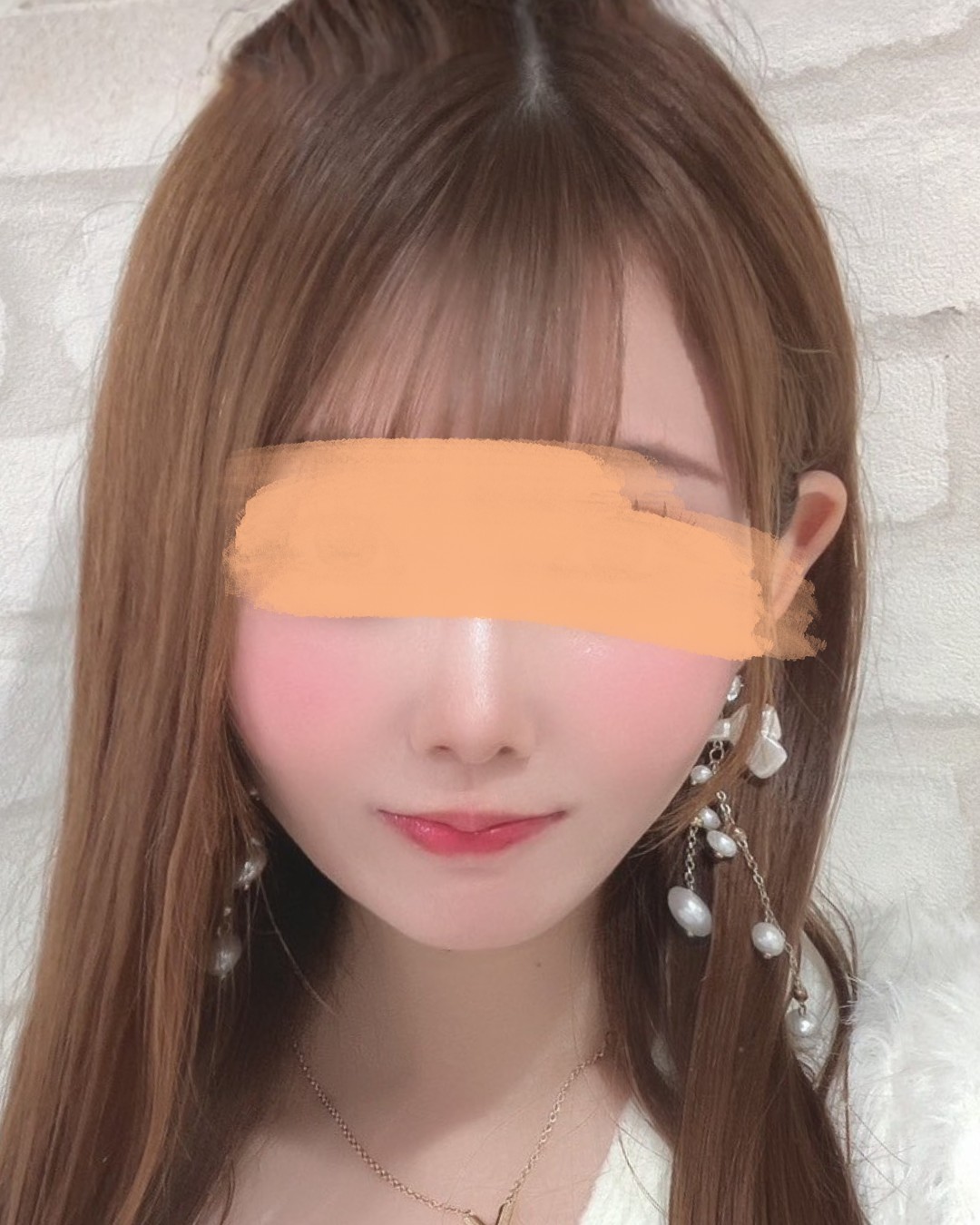 人生変わる小顔術 AFTER写真