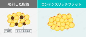 吸引した脂肪とコンデンスリッチファットの比較