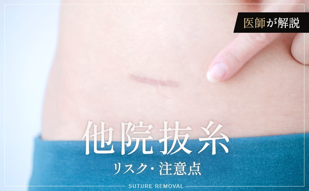 他院抜糸とは？リスクや注意点、術後に気をつけることも医師が解説