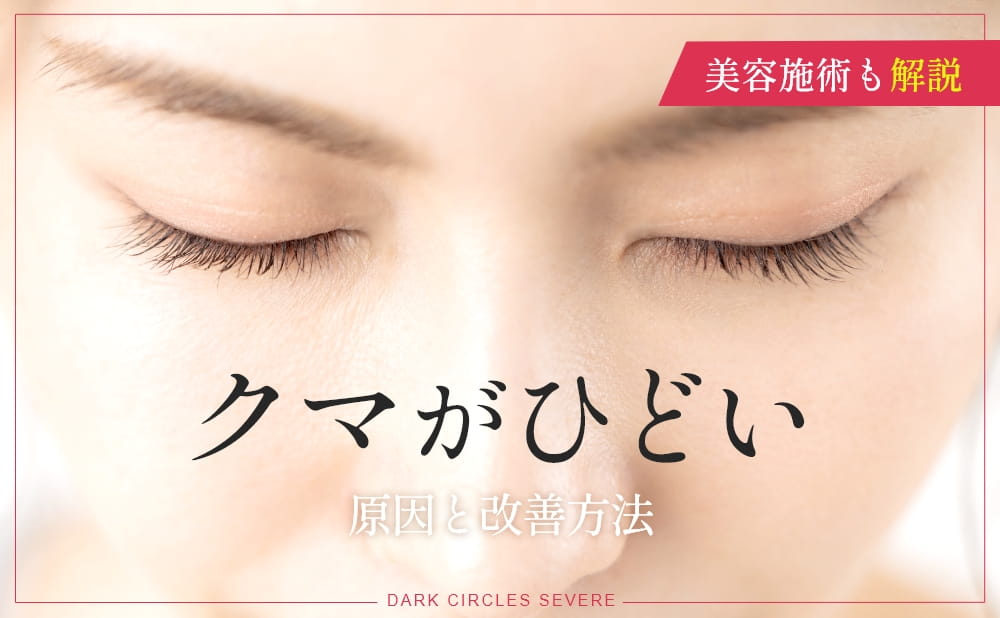 クマがひどい原因と解決法