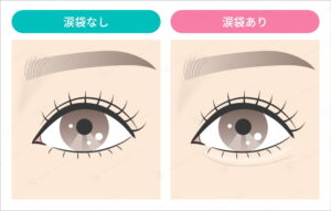 涙袋がない目と涙袋がある目の比較
