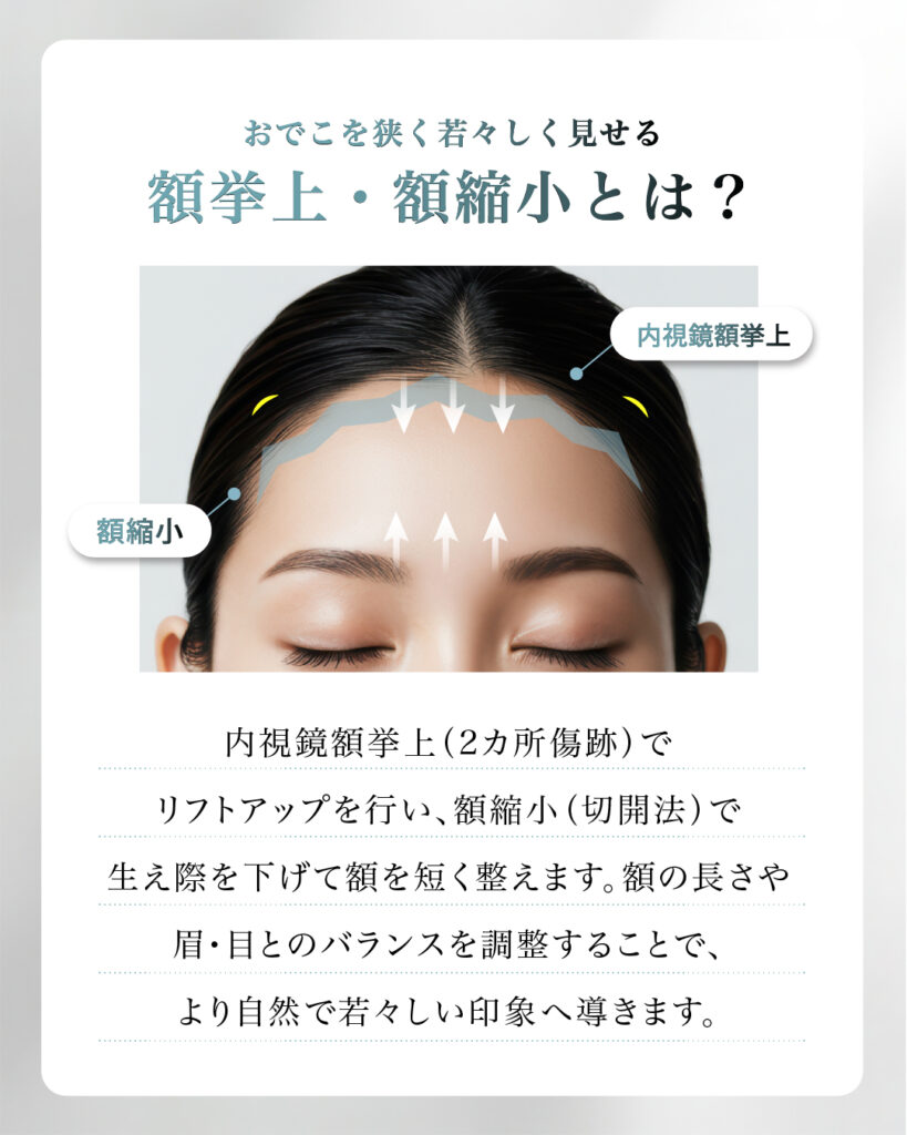 『【最新技術の融合】「おでこを広くしたくない」方へ。内視鏡額挙上・額縮小術を解説』の画像