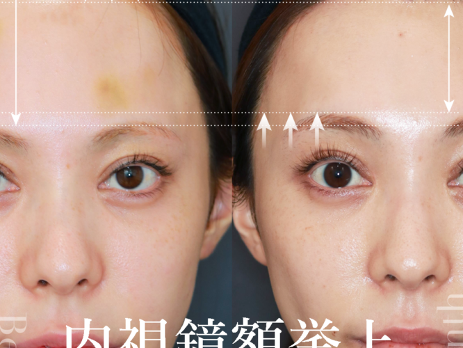 20821イシダアヤカ3M