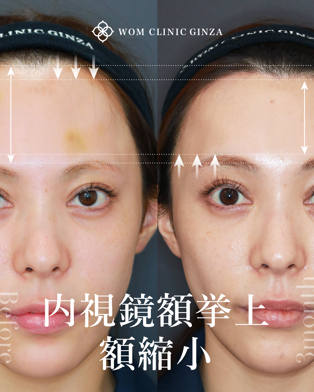 20821イシダアヤカ3M