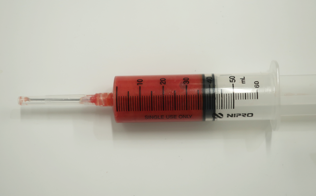 『自然に整える輪郭形成 輪郭3点骨切り×脂肪吸引』の画像