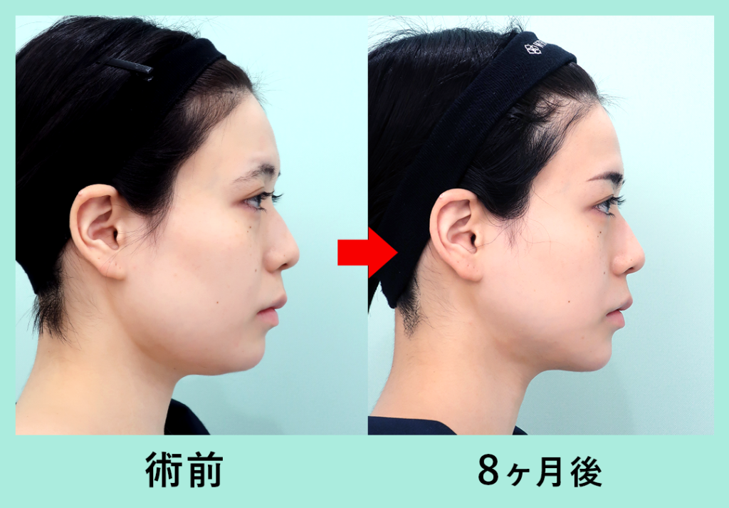 『柴田作成しました。作成しました。』の画像