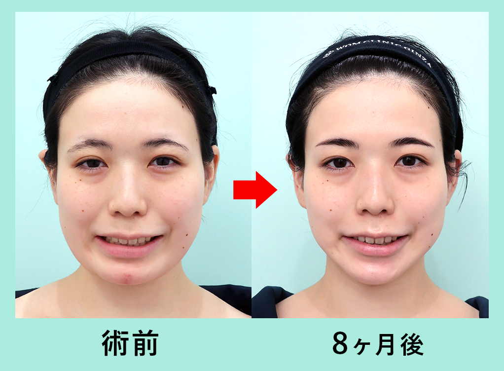 『柴田作成しました。作成しました。』の画像