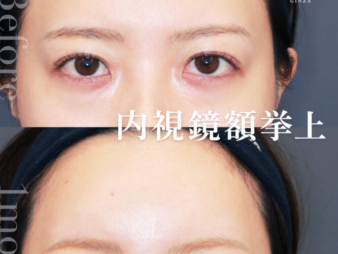 21482オオムラアヤ