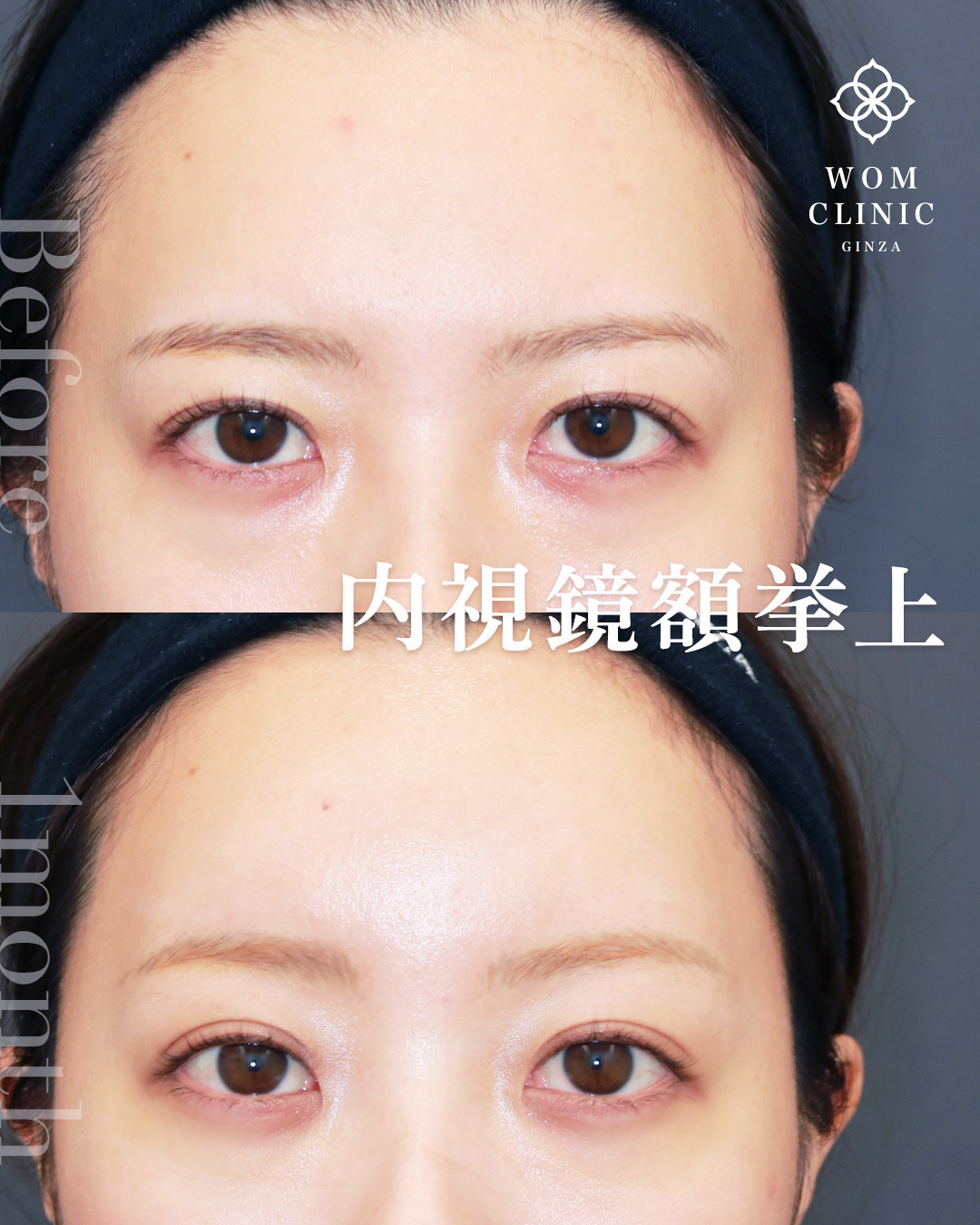 21482オオムラアヤ