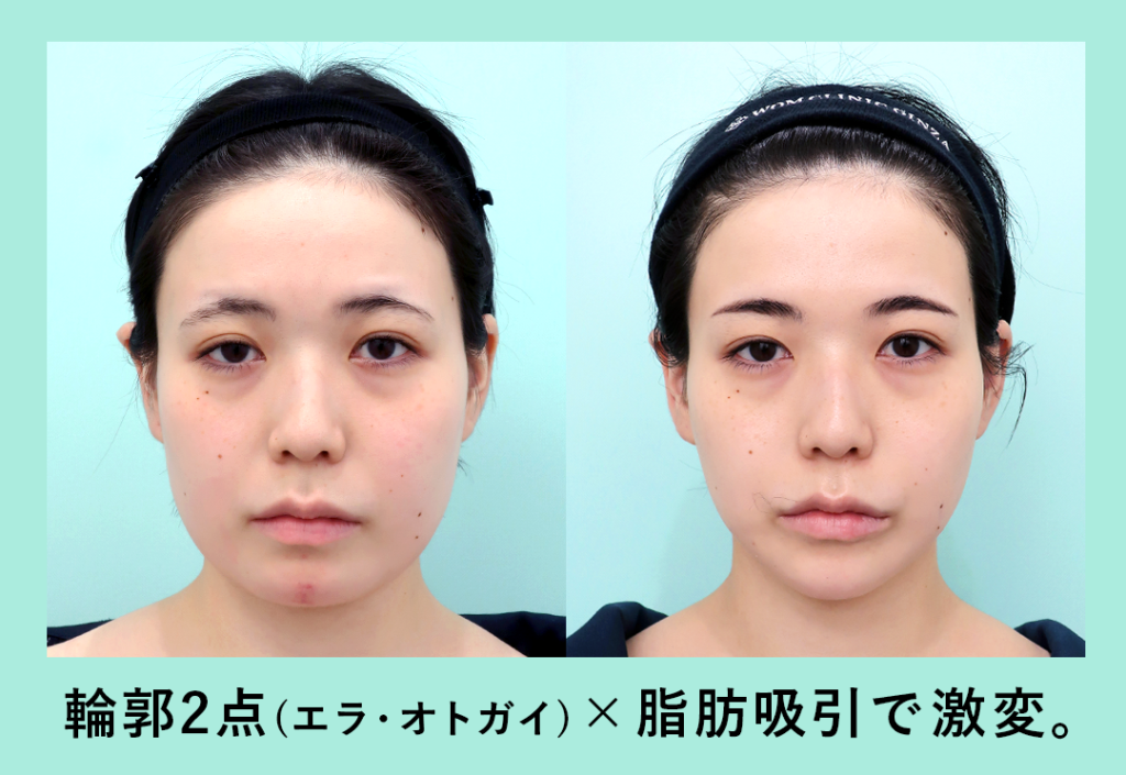 『柴田作成しました。作成しました。』の画像