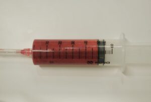 『輪郭施術で垢抜けを。本来の美しさを引き出す『顔の脂肪吸引』。』の画像