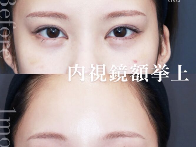 21612ハヤシマオ