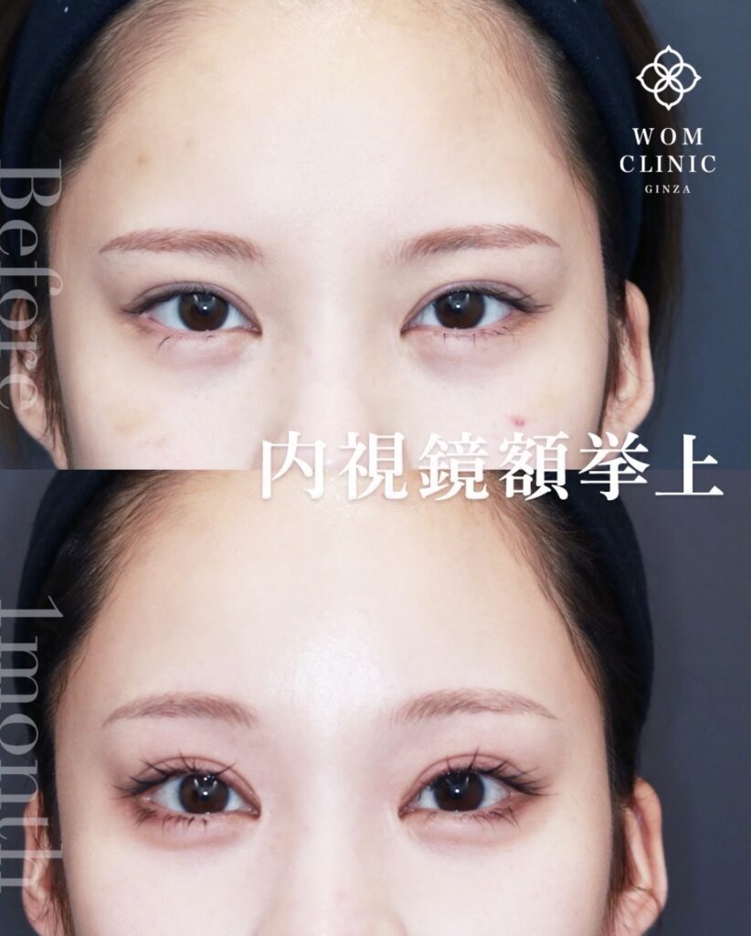 21612ハヤシマオ