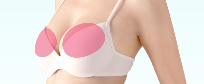 アクアフィリング除去