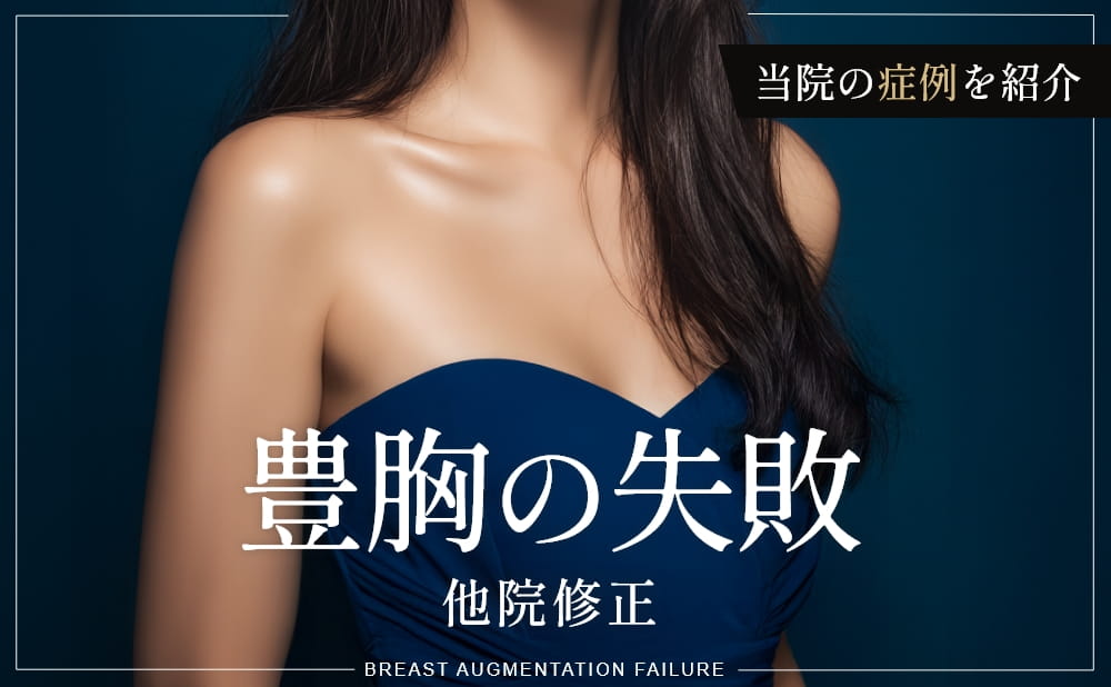 豊胸の失敗例とは？失敗を防ぐ方法や他院修正が必要なケース・当院の症例を紹介