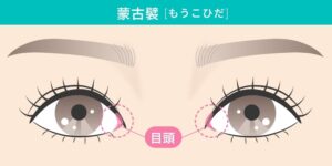 目頭と蒙古襞の目の構造を示す図
