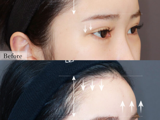 9175モチヅキクルミ2M