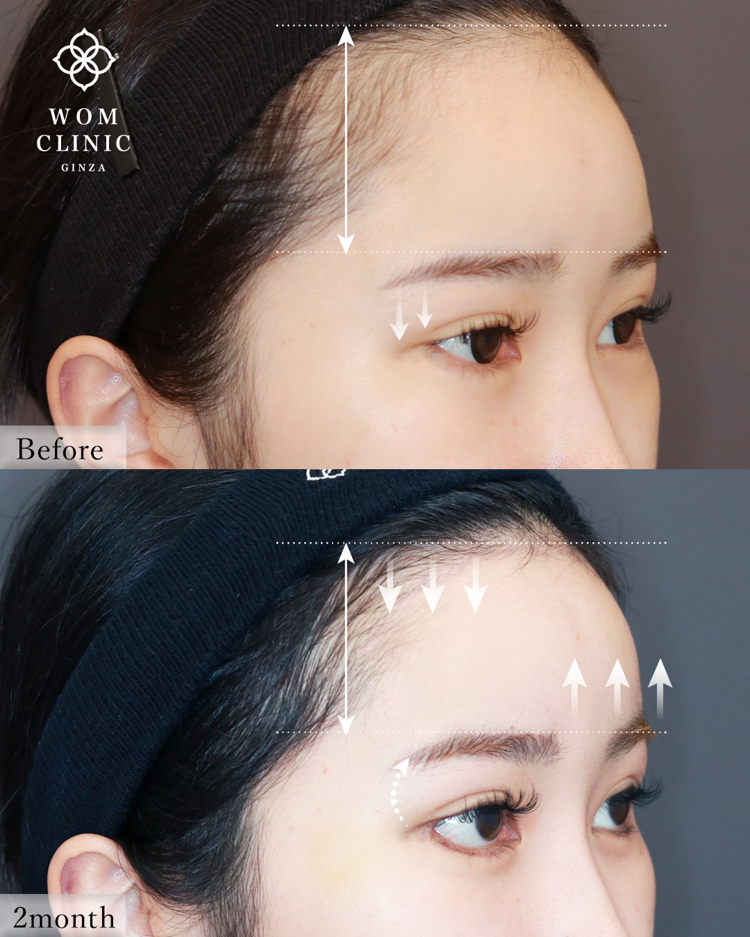 9175モチヅキクルミ2M