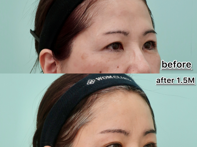 21476サカモトマサコ1M