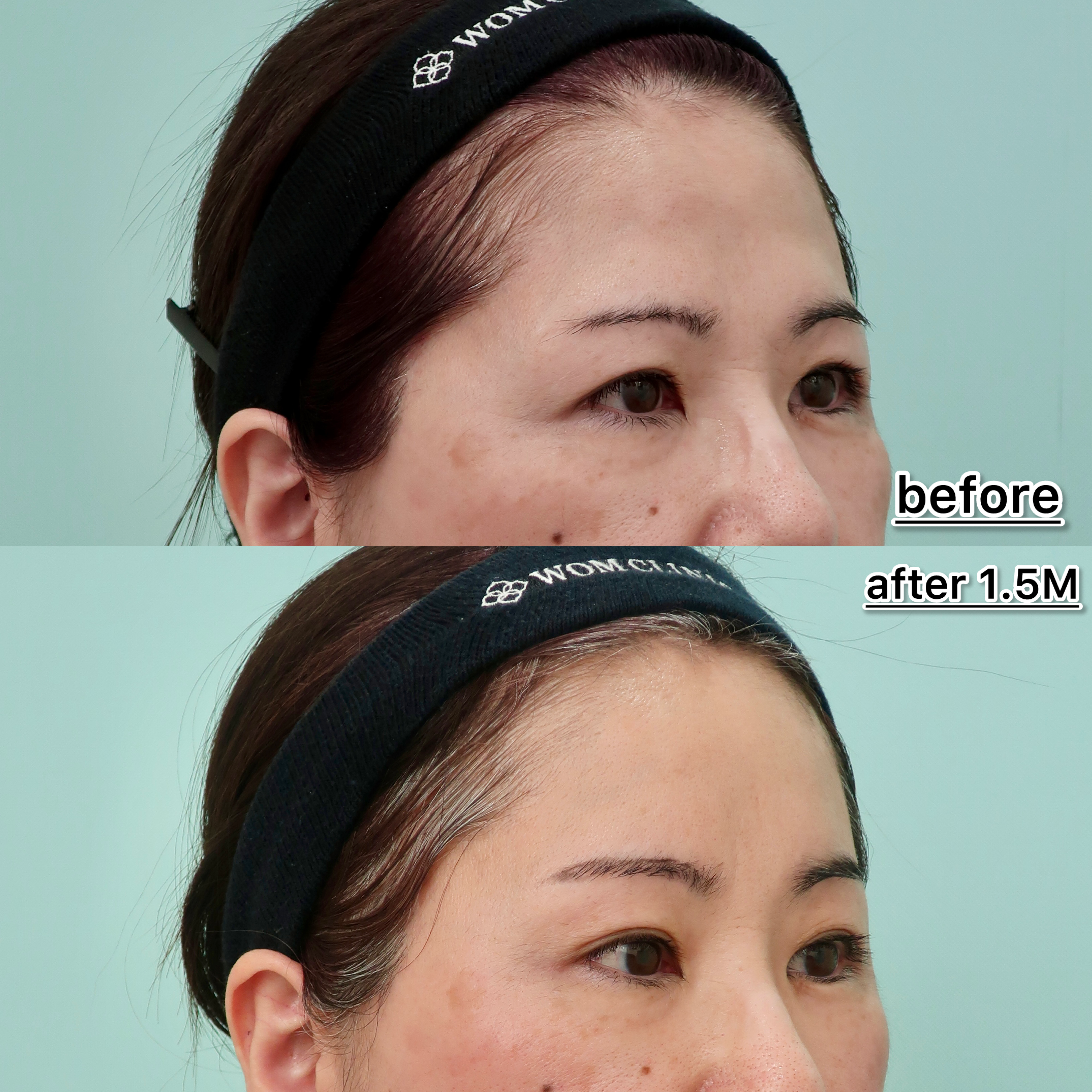 21476サカモトマサコ1M